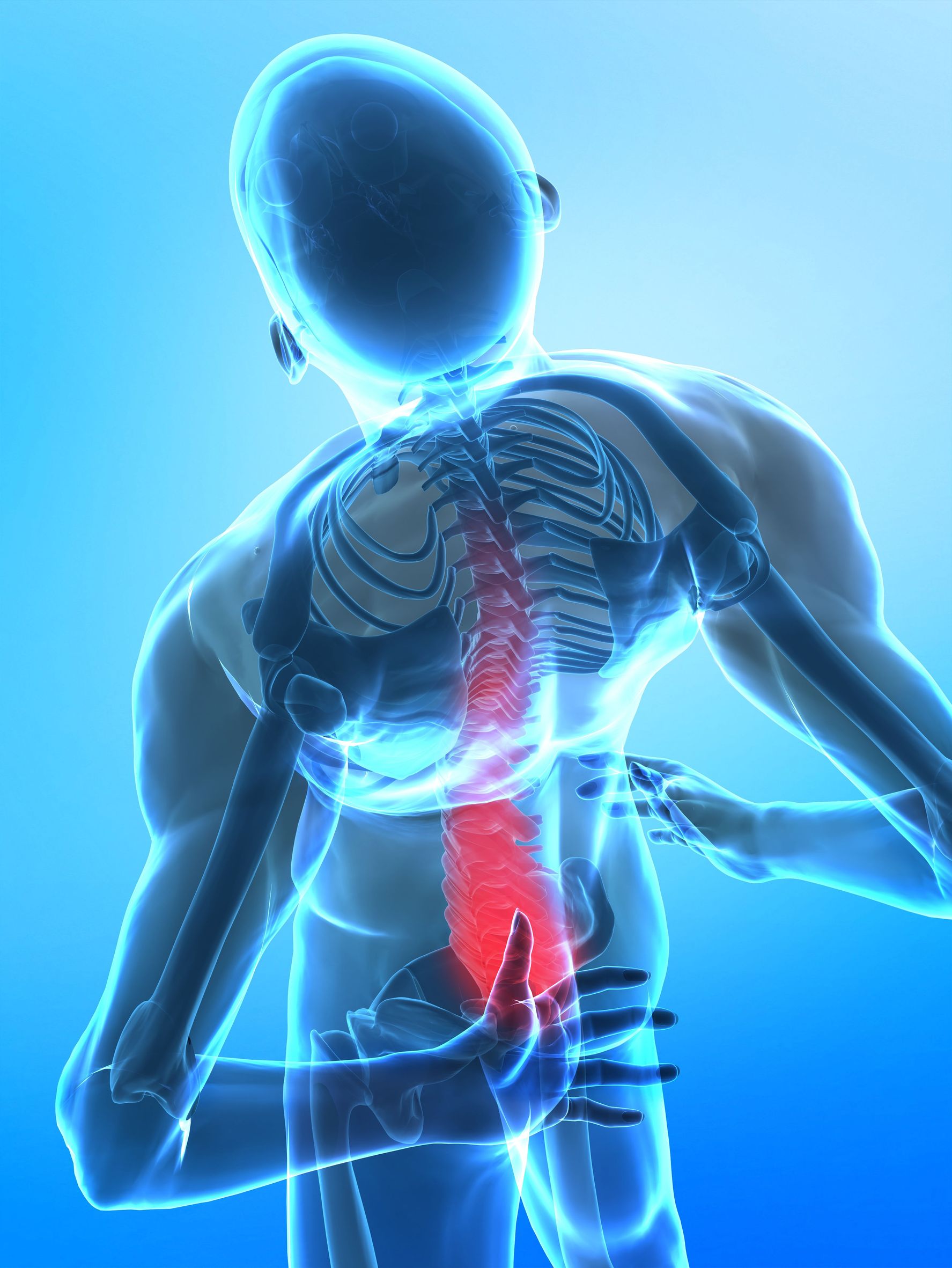 Back Pain Relieve With Epidural Steroid Injections in Moore