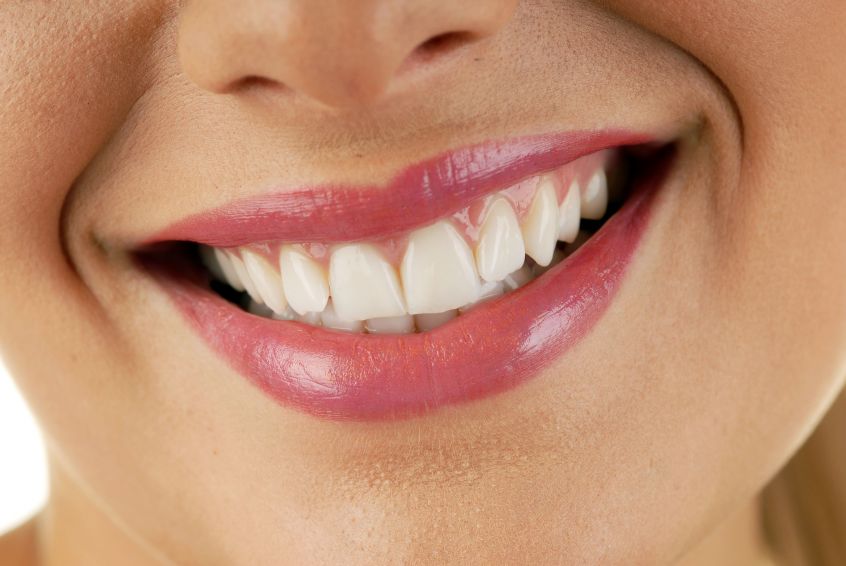 Preventative Steps to Protect Your Smile