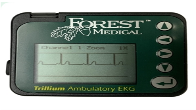 Four Advantages of Using a Monitor Holter To Check on Your Body Condition