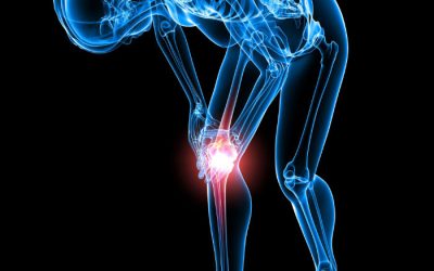 Understanding Modern Approaches to Knee Pain Treatment in Kansas City, MO