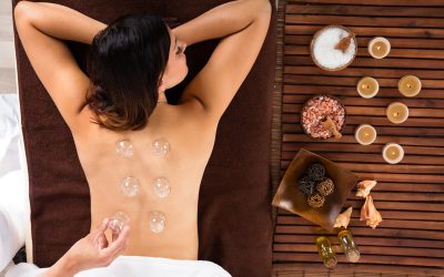 Benefits of Cupping Westford MA